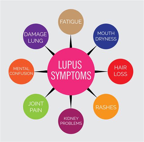 lupus diagram 